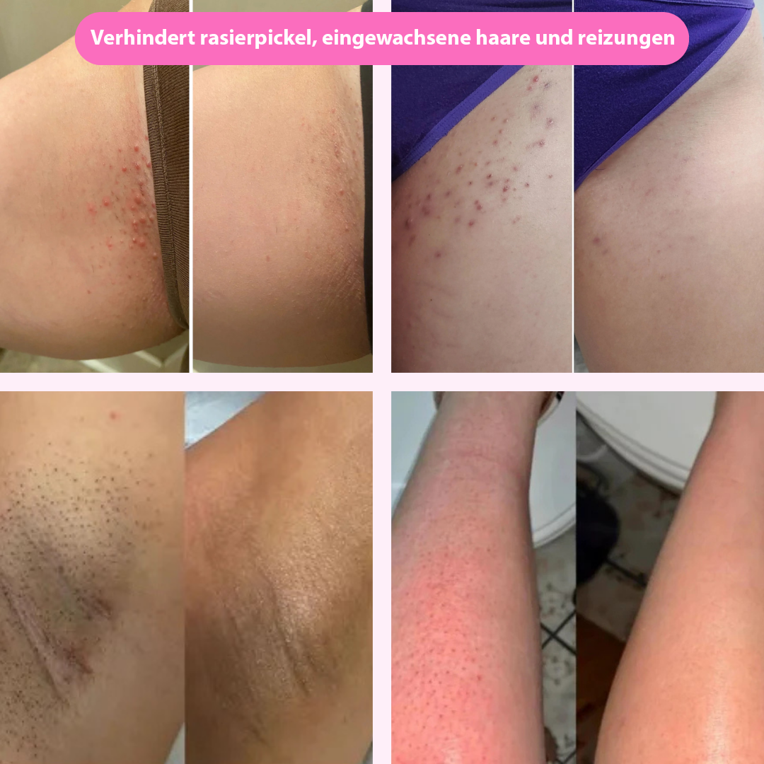 Rasierer 2.0 : für eine sanfte Rasur unterwegs!